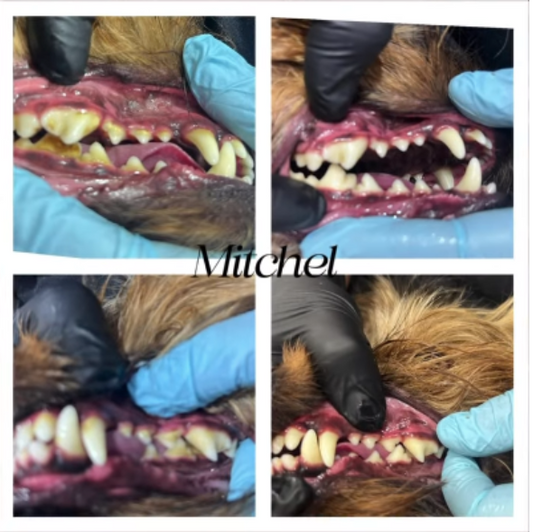Cosmetic Teeth Cleaning Service